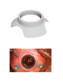 STEADYRING – SELF STABILIZING RING